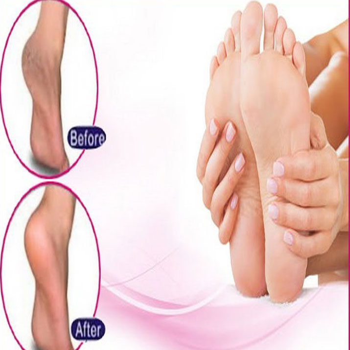 KRIKA Foot Care Cream For Rough, Dry and Cracked Heel, Foot Cream For Heel  Repair, Healing