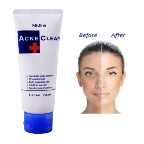 Mistine Acne Clear Facial Foam 3